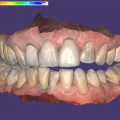 exocad-dentalcad-31-rijeka-small-2