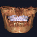 exocad-dentalcad-31-rijeka-small-1