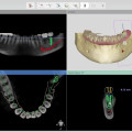 3shape-dental-system-2022-unite-ortho-system-implant-studio-small-4