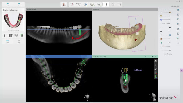 3shape-dental-system-2022-unite-ortho-system-implant-studio-big-4